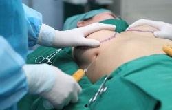 女子隆胸照片  第3张